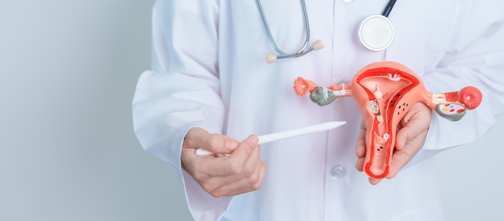 Doctor holding Uterus and Ovaries model polycystic ovarian syndrome concept