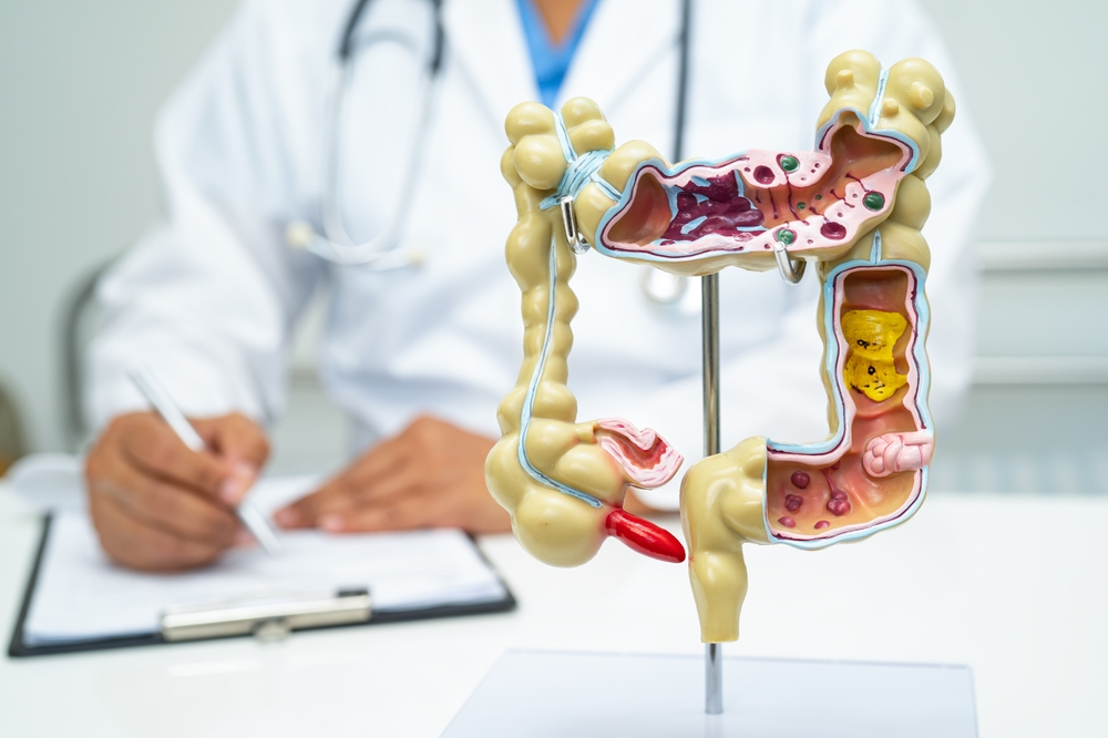 anatomical model of intestine appendix and digestive system with doctor in the background